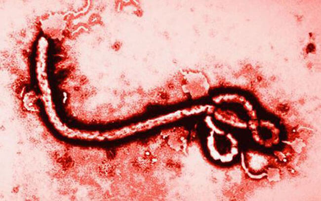 Tại sao virus Ebola lại vô cùng nguy hiểm
