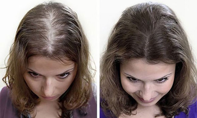 tinh dầu bưởi có tác dụng kích thích mọc tóc